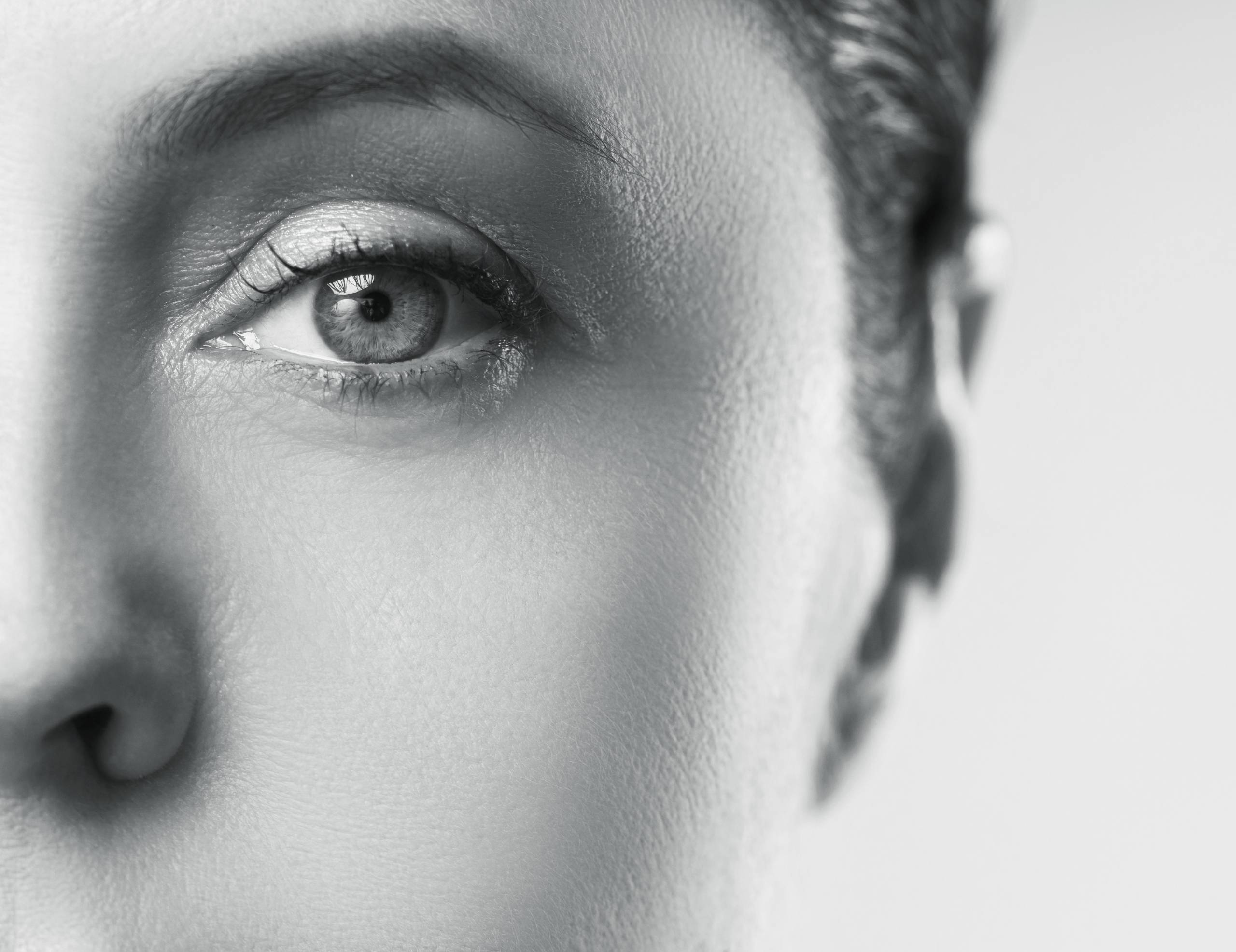 Estetica e Sorriso - Upper Blepharoplasty Before