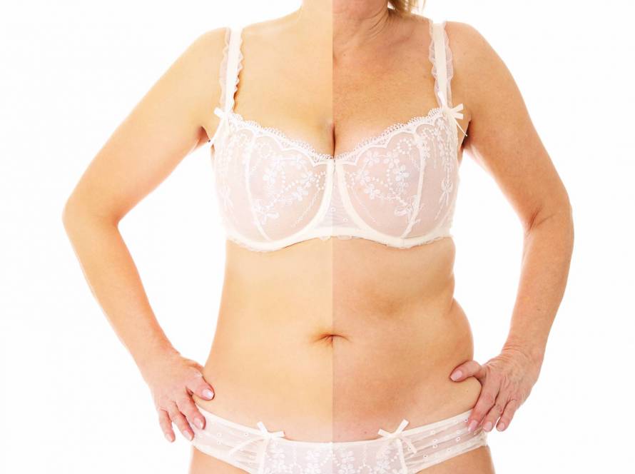 Estetica e Sorriso - Liposculpture